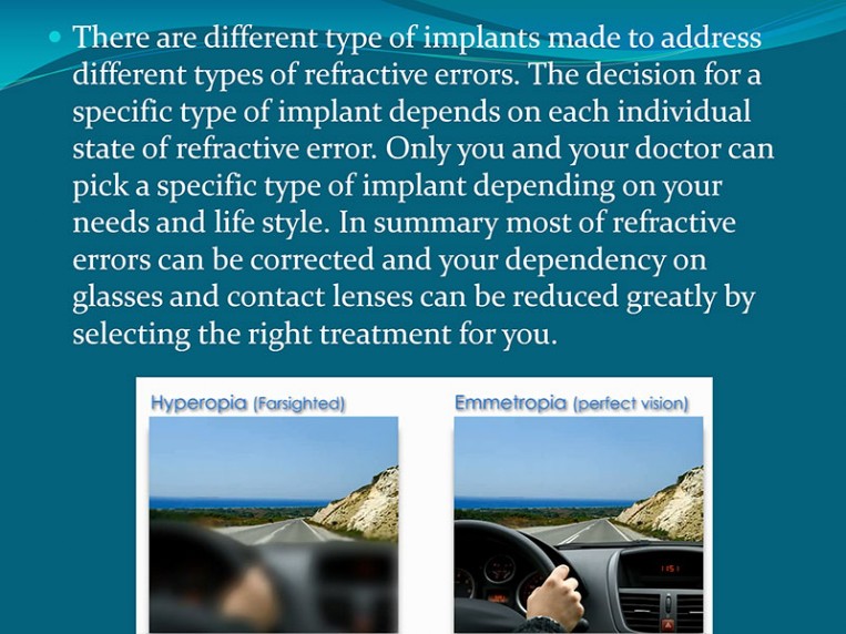 Cataract Explanation 6